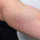 천연제품 | 성인 아토피 바디 로션 얼굴 몸 다 바르는 천연제품 후기