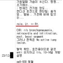미묘한 차이 이미지
