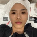 강북이지함피부과의원 | 종로피부과 내돈내산 덴서티알파팁 600샷 통증 회복기간 부작용