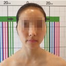 현세탁 | [현] 대구 수성구 예신 관리 &#39;더 라인 뷰티&#39; 광대 경락 내돈내산 후기