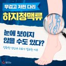 [카드뉴스] 무겁고 저린 다리 하지정맥류, 눈에 보이지 않을 수도 있다? 이미지