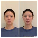 예비신부관리 추천 소니드 윤곽 대치도곡점 후기