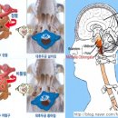 라진틔움 바디워크~ 반복되는 만성 두통.. 의 정체 ^^ 이미지