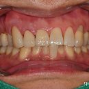 더바른치과기공소 이미지