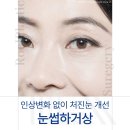 올리브영골든스퀘어 | 대구 눈썹거상 잘하는곳 찾는다면? 처진눈 고민 자연스럽게 개선하는 방법