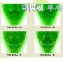 미병원 이미지