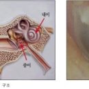 수원보청기센터 이미지