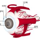 녹내장 이미지