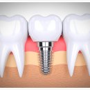 윈스치과의원 이미지
