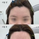 모두왁싱 | 의정부 왁싱샵 헤어라인 왁싱, 모두올왁싱 후기