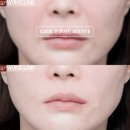 명품피부과의원 티스토리