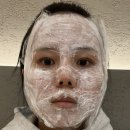 부평한의원 | [내돈내산][부평 피부과] 편평사마귀 성지- 1일차 후기 [끗 한의원 부평]