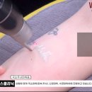 삼성필의원 | 컬러 문신 정복! 수원 문신제거, 원스의원 &#39;트리플 피코&#39;의 완벽한 색소 커버리지