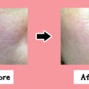 (A+)바른케어 이미지