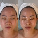 수화 | 부천중동피부관리 추천! 홍조 때문에 찾은 서아담에스테틱 수화강테라피 후기
