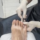 고덕역 | 오라소마네일 푸스케어 고덕역점 강동구무좀발톱 관리 후기