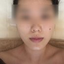 예뻐지는공간 | 웨딩관리ㅣ인천 송도 에스테틱 <예뻐지는공간> 윤곽관리 첫방문 후기