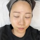 도플라충남본부 | 아산기미관리 뷰마르 아산배방점에서 기미플라 받았어요~!