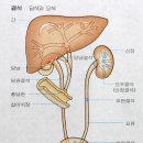 결석 結石 (calculus) 이미지