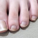 아이풋네일 이미지