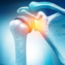 네온정형외과의원 이미지