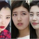 수헤어라인 이미지