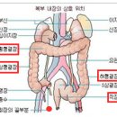 S상 결장 이미지