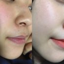 이오스타 이미지