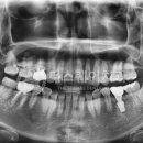 더스퀘어치과기공소 이미지