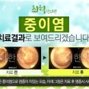 최혁한의원 네이버블로그
