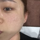 홍익인간 제2 인성관 | 대구 스킨보톡스 잘하는 곳 중구 반월당 피부과 찐후기