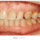 부천치과잘하는곳? 2가지 포인트만 체크하세요 [의사]