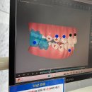 유니콘치과의원 | 압구정로데오역 임플란트 전문 치과 잘하는 곳 추천 BEST 6곳