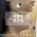 올라3 | 천안 봉명동 이중턱 리프팅 올라웨이브 내돈내산 후기