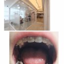 새로치과교정과의원 네이버블로그