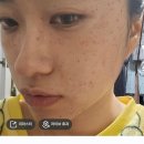 성지타워3차 | 편평사마귀 지옥에서 누가 돌아왔게