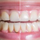 일산웰치과의원 이미지