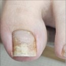 경산집 영천점 | 영천 경산 내성발톱 아픈발톱 여기 가보세요! 재은네일뷰티 페디크루 영천점