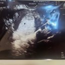 코레일대전어린이집 | [공지] 2026 대전 임산부 혜택 총정리 임신하면 바로 해야 할 일 체크리스트