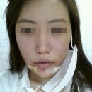 스마트프레쉬 이미지