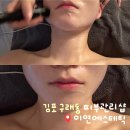 J7006 | 김포 구래동 피부관리 : 이연에스테틱 얼굴 윤곽관리 전후차이비교 솔직후기
