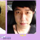 예미원피부과
