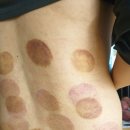 발산마곡올바른마취통증의학과의원 이미지