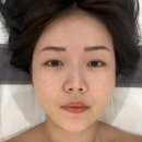 (주)비햅틱스 | 어느 날 부터 자꾸 턱 밑에 살이 붙어 경각심을 갖고 방문한 &#34;스킨디벨럽/안양피부관리&#34;
