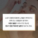 자칫 실명으로…‘황반변성(macular degeneration)’ 주의하세요 이미지