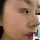 진테라피에스테틱 이미지