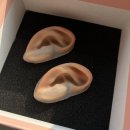 휴먼브릿지 | 홍천 소이증 보형물 제작 및 후기 [휴먼브릿지 스튜디오]