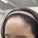 매곡천 자전거길L | 사상 왁싱 추천｜바이엘왁싱 헤어라인 왁싱 솔직후기