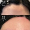 신정로203번길L | [울산] 친절한 일대일 맞춤 울산 왁싱샵, 맨들왁싱&amp;피부 울산점 / 하프페이스 솔직후기