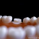 서울바른이치과의원 네이버블로그